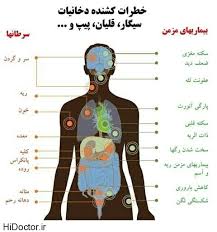 نتیجه تصویری برای مضرات نوشابه