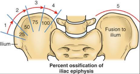 آخر عمر لاستخدام حزام اعوجاج العمود الفقري