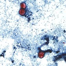 cyclospora cayetanensis