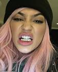 Gold Grillz. How It Works! (Dr. Kelly, Miami) -