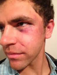 A new lawsuit accuses the Hawthorne Police Department of beating Jonathan Meister as he tried to tell them he was deaf during a confrontation in Feburary ... - article-2561795-1B984D1800000578-838_634x829