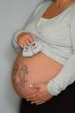 Laserbehandlung während Schwangerschaft Tipps für Schwangere