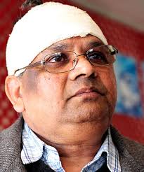 ATTACKED: Hamilton dairy owner Jagdish Thakur is recovering after a brutal assault left him with bruises on his face and nine stitches in his head and ear. - 7297049