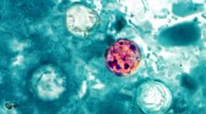 Climate Change's Hidden Harvest: How Warming Temperatures Are Fueling the Spread of Cyclospora Outbreaks in the US