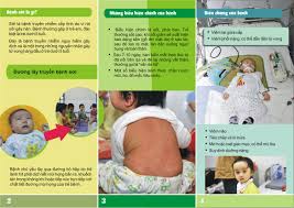 Kết quả hình ảnh cho bệnh sởi