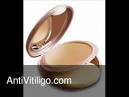 Vitiligo Makeup Dermablend Professional