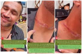 Secretário machuca pescoço em fio solto durante "rolê" de moto em Cuiabá; vídeo