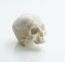 Lithoz: 3D printing for ceramics