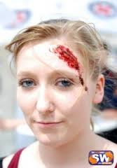 Mit dabei: Die 17 Jahre alte Lena Koch (Foto) aus Kützberg. Sie bekam fachkundig eine Platzwunde auf die Stirn gemalt und auch ein paar ... - Verkehrssicherheitstag-00-209x300