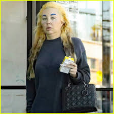 What’s Next for Amanda Bynes After Her Hair Transformation?