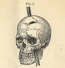 Le Cas de Phineas Gage