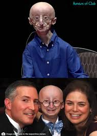 Sam Berns' philosophy for a happy life despite progeria