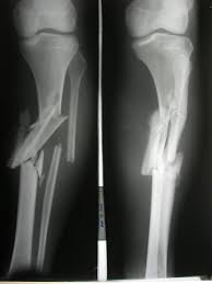 Related image