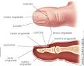 Avulsione completa dell unghia
