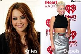Resultado de imagem para antes e depois dos famosos