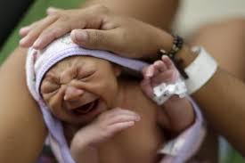 Image result for picture of BABIES WITH ZIKA VIRUS