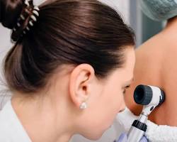 Dermatologist