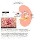 Gonflage azotemia