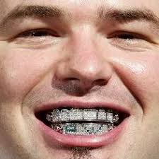 Image result for teeth grillz