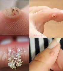 BE VERY CAREFUL 🤧🤧 . If you get this, you are infected with &hellip;. See more