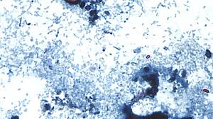 What to know about cyclosporiasis cases in D.C., Maryland and Virginia