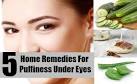 11 Quick Remedies for Puffy Eye Bags