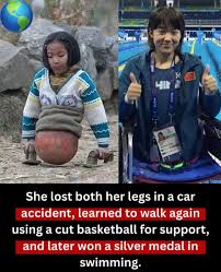 Xplore - She Had No Legs… But She Never Lost Hope 🤍🏀 At ...
