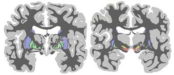 Image result for ventral striatum
