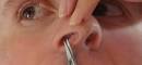 Des poils dans le nez assez gnants. que faire : Forum Epilation