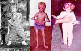 Image result for depleted+uranium+babies