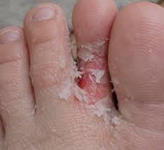 wifelore | &ldquo;Jack look at my foot! &ldquo; baby that's gross&hellip;&rdquo;Who ...