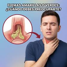 Que Es Flema Amarilla | TikTok