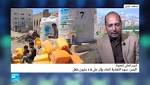 اليوم العالمي للطفولة: سوء التغذية