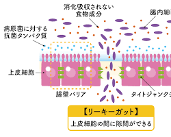 リーキーガット症候群の模式図の画像