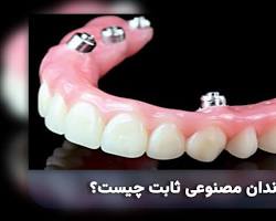 تصویر دندان مصنوعی