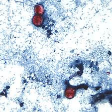 U.S. health officials are investigating a new outbreak of a diarrhea-causing parasite