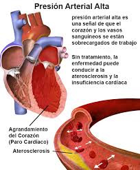 Resultado de imagen para imagenes de presion arterial