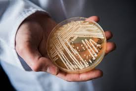 Superbug confirmed in 23 states: Where is the deadly fungus spreading in 2026?
