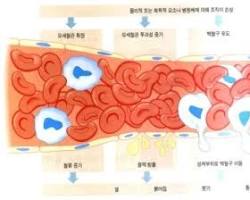 염증 반응 과정