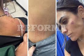 Agreden a Alcaldesa de Cuauhtémoc comerciantes de San Cosme