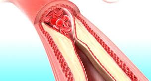 Imagini pentru scadere colesterol