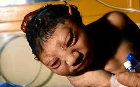 Image result for depleted+uranium+babies