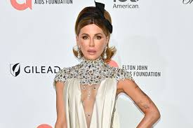 Kate Beckinsale Scrubs Instagram amid Body-Shaming After Mast Cell Disease Diagnosis