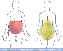 صورة different body shapes apple vs pear illustration