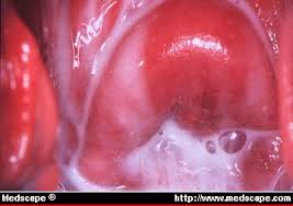 Image result for picture of vagina bacteria