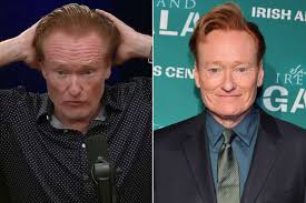 Conan O’Brien Blames Scalp Burn That Felt Like ‘Fire’ for Why His ‘Different’ Hair Look Has Gone Viral