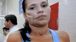 mexicana mariscos proveedor Karla Flores que se llama la “Mujer del Milagro.” ¿Por qué? Ella sobrevivió con una granada alojada en su rostro. - karla_flores_1_620x350