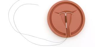 Image result for IUD image