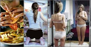 Resultado de imagen para desordenes alimenticios en bailarines
