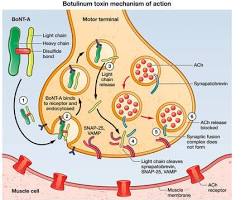 Image of Botulinum toxin